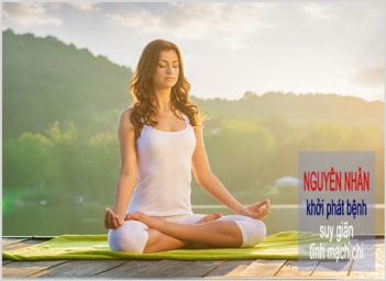 Nguyên do có thể khởi phát suy giãn tĩnh mạch chân tay cần biết